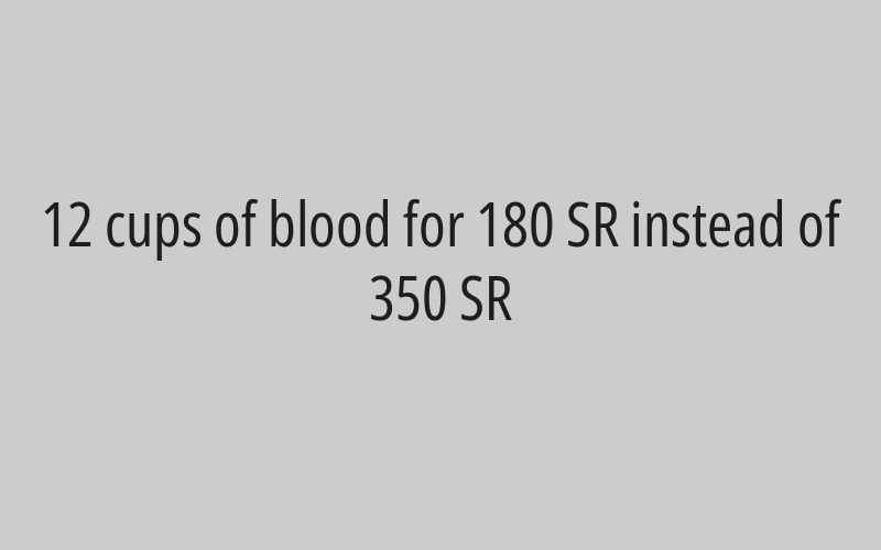 3 immune cupping cups for 90 SR instead of 120 SR