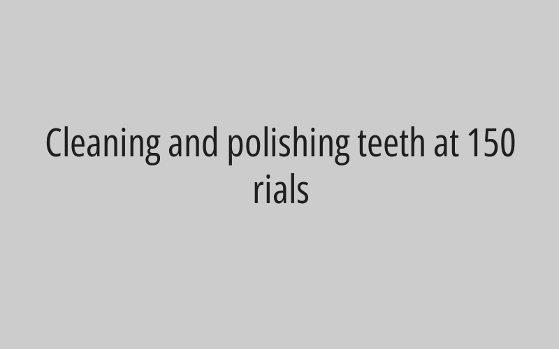 Cleaning and polishing teeth at 150 rials 