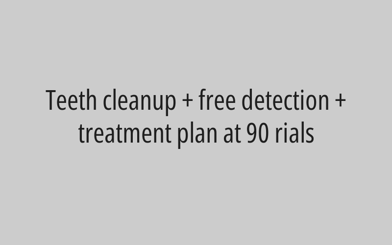 Laser carving at 490 rials 