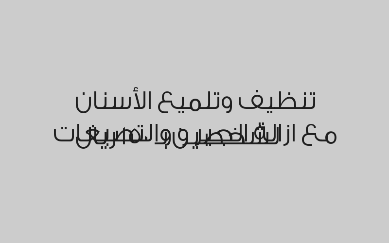 توريد لثة بالليزر للفكين بـ 800 ريال