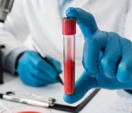 مخزون الحديد