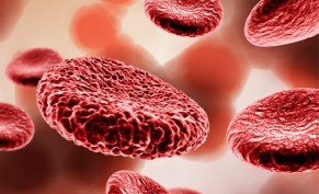 Complete blood count