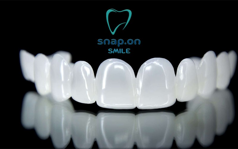 سناب اون سمايل للفكين